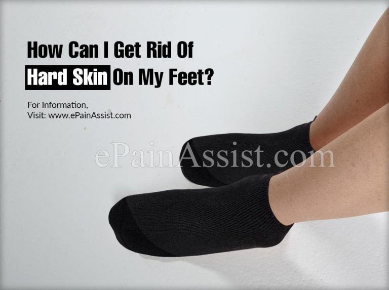 How Can I Get Rid Of Hard Skin On My Feet?