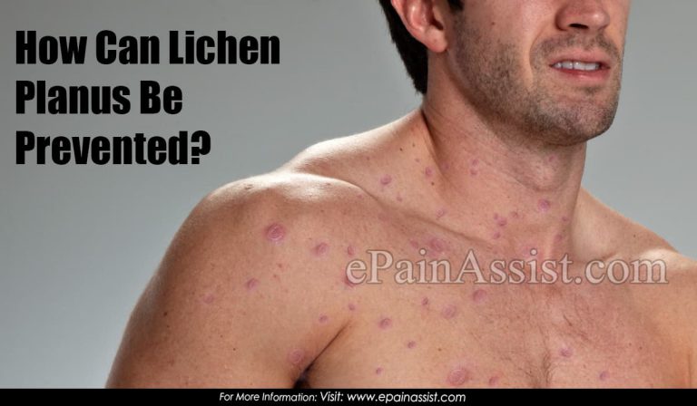 How Can Lichen Planus Be Prevented?
