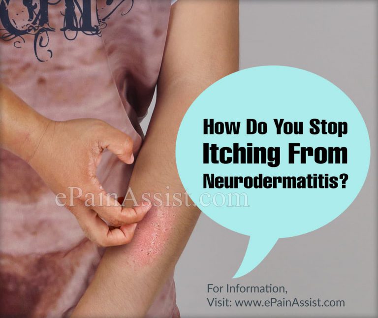 How Do You Stop Itching From Neurodermatitis & Does Doxepin Help?
