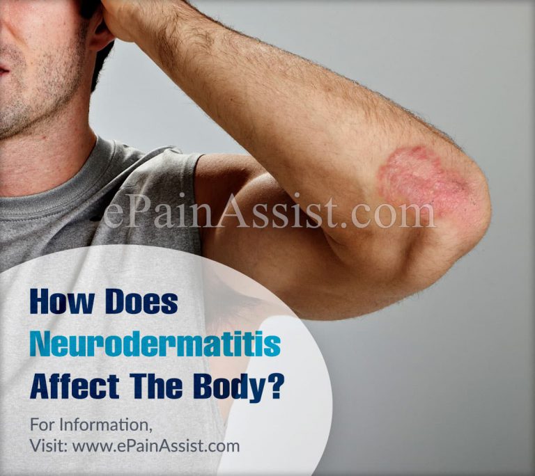 How Does Neurodermatitis Affect The Body & What Triggers It?