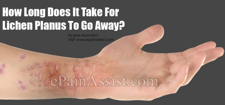 How Long Does It Take For Lichen Planus To Go Away?