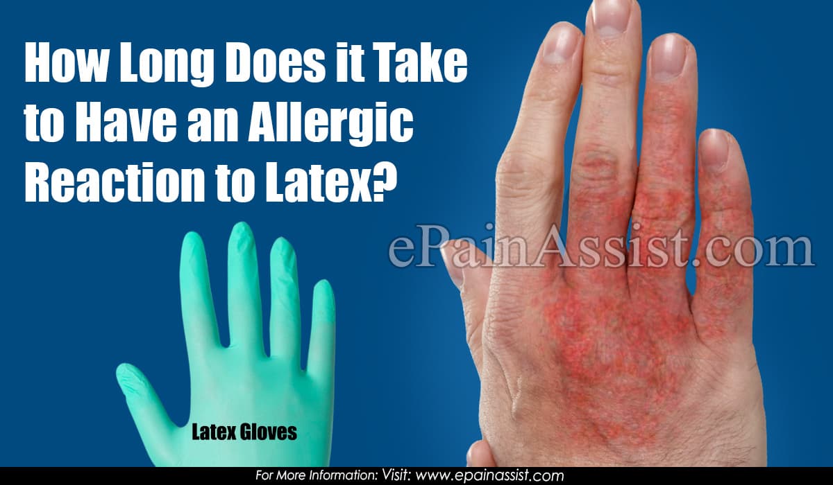 How Long Does it Take to Have an Allergic Reaction to Latex?