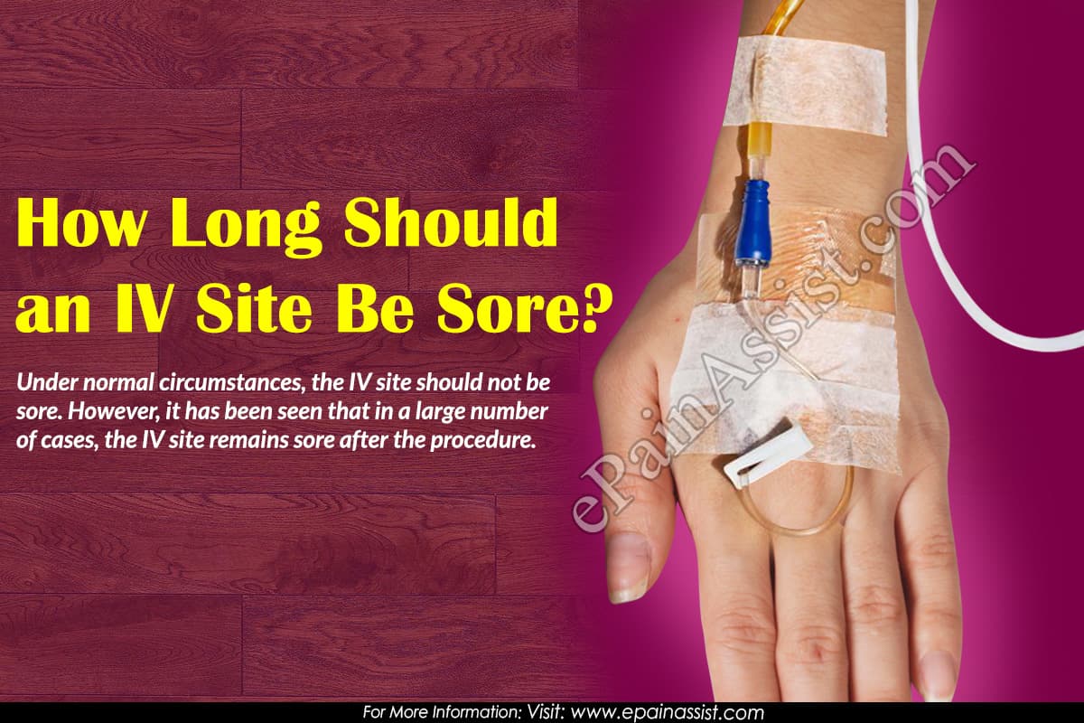 How Long Should an IV Site Be Sore?