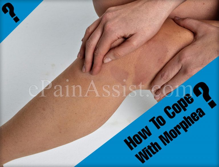 How To Cope With Morphea?