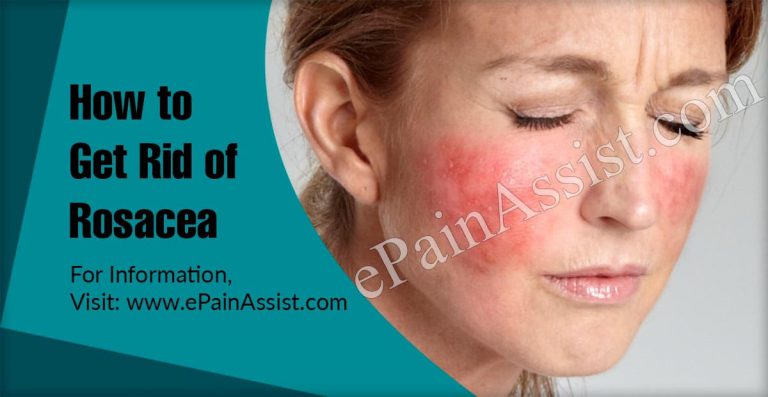 How to get rid of Rosacea