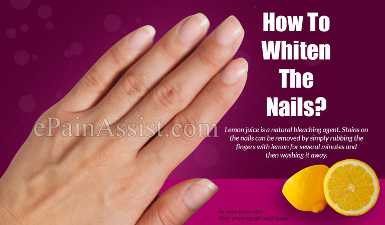 How To Whiten The Nails?