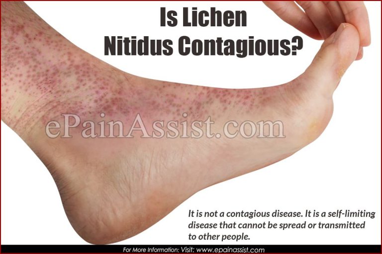 Is Lichen Nitidus Contagious?