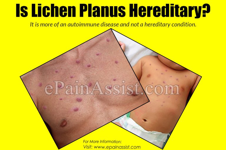 Is Lichen Planus Hereditary?