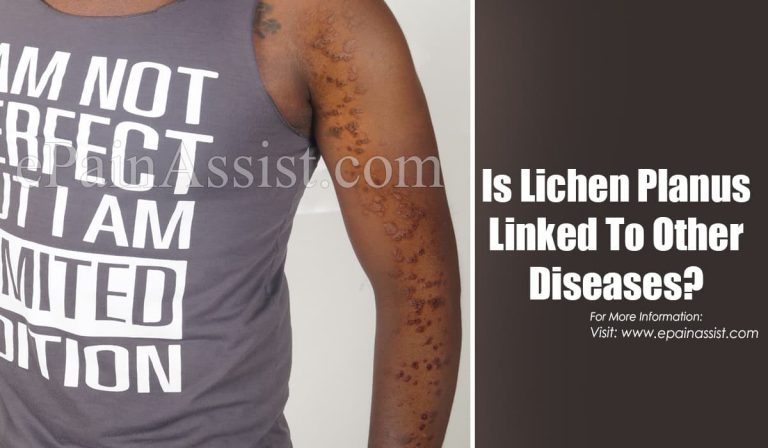 Is Lichen Planus Linked To Other Diseases?