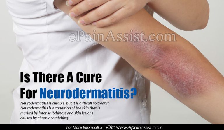 Is There A Cure For Neurodermatitis?