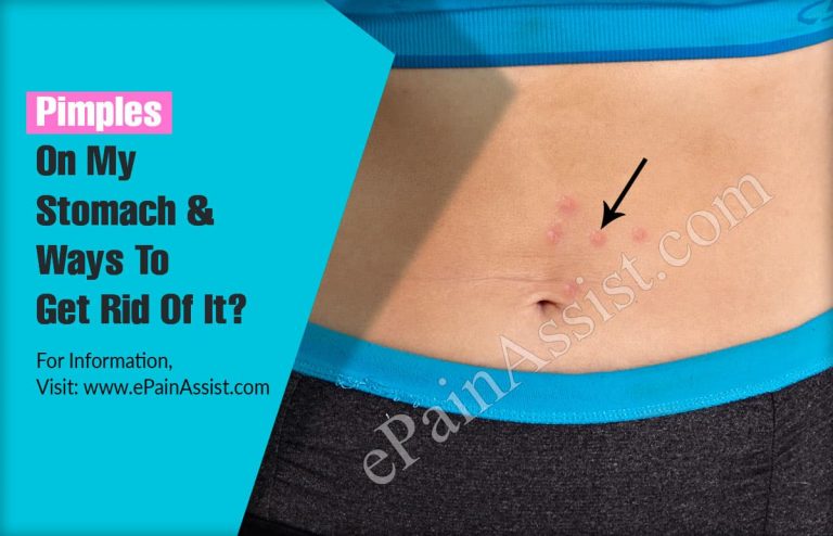 Pimples On My Stomach & Ways To Get Rid Of It?