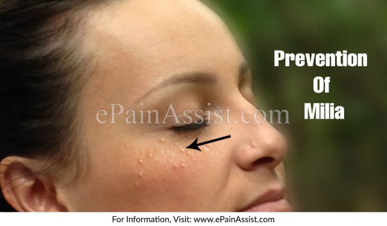 Prevention Of Milia