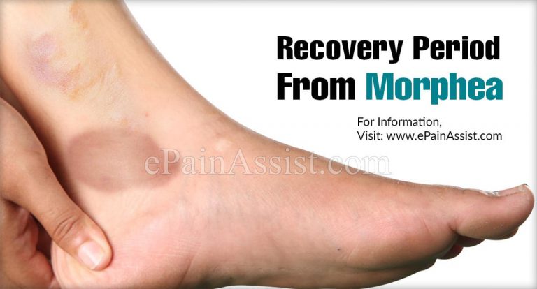 Recovery Period From Morphea