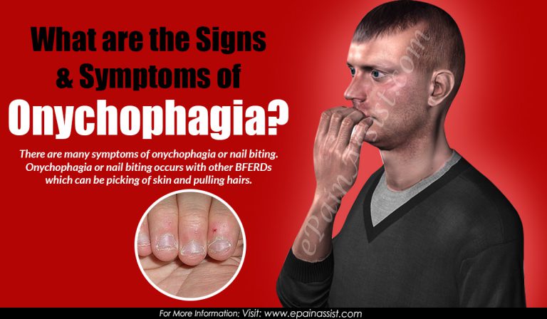 Signs & Symptoms of Onychophagia, Its Harmful Effects, Causes & Ways To Stop Nail Biting