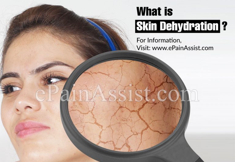 Skin Dehydration: What Are The Signs Of Dehydrated Skin And What To Do For It?