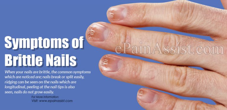 Symptoms of Brittle Nails & What Vitamins Are Lacking When You Have Brittle Nails?