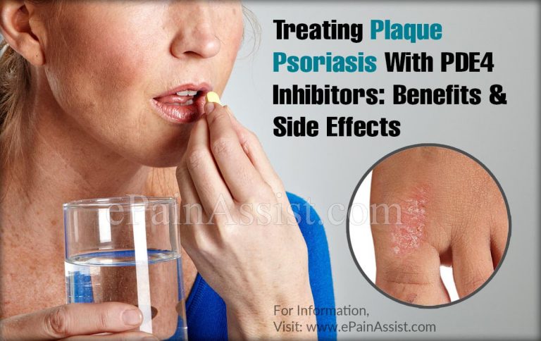Treating Plaque Psoriasis With PDE4 Inhibitors: Benefits & Side Effects