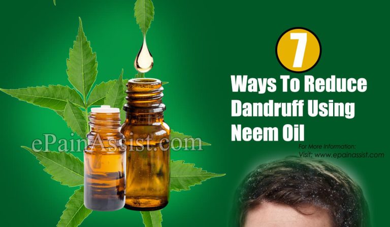 7 Ways To Reduce Dandruff Using Neem Oil