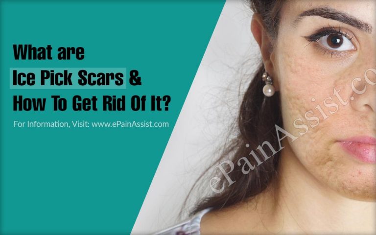 What are Ice Pick Scars & How To Get Rid Of It?