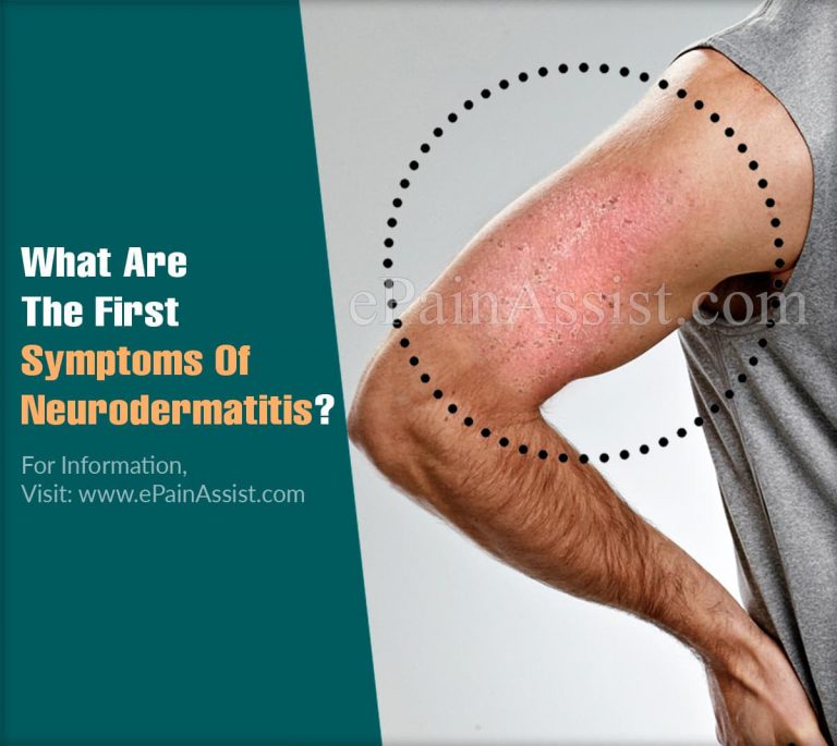What Are The First Symptoms Of Neurodermatitis & How Do You Test For It?