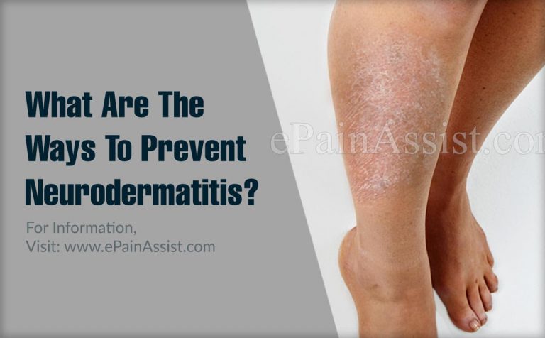 What Are The Ways To Prevent Neurodermatitis & Does It Recur?