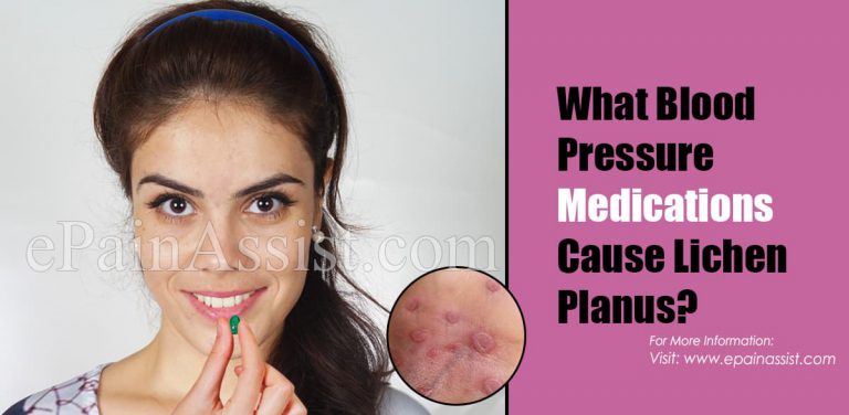 What Blood Pressure Medications Cause Lichen Planus?