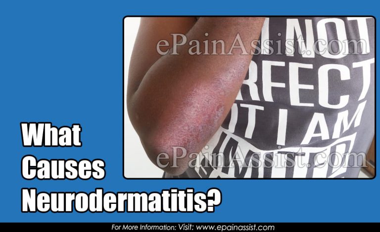 What Causes Neurodermatitis?