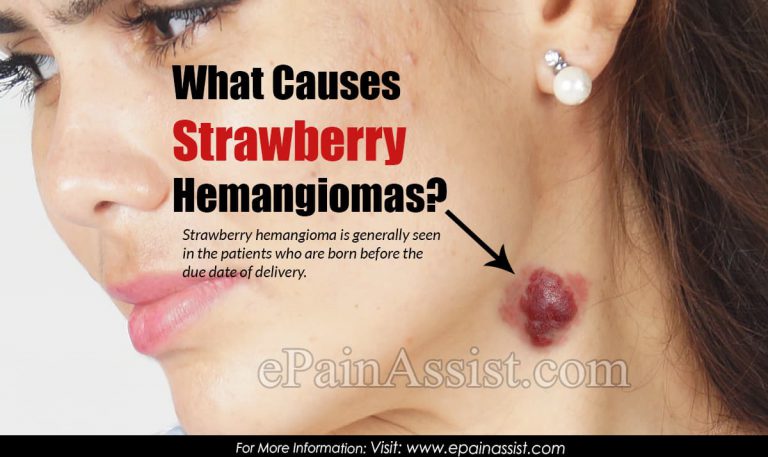 What Causes Strawberry Hemangiomas?