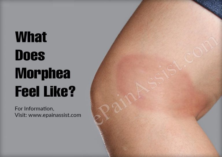 What Does Morphea Feel Like?