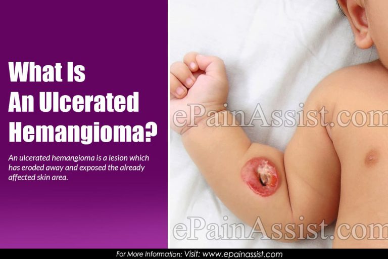 What Is An Ulcerated Hemangioma?