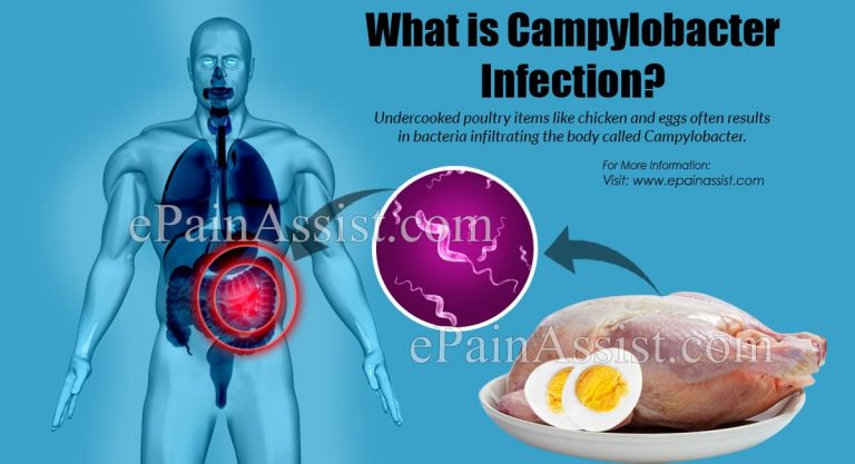 What is Campylobacter Infection & How is it Treated?|Causes Symptoms, Prevention of Campylobacter Infection
