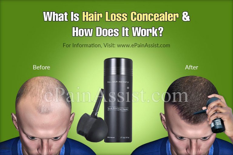 What Is Hair Loss Concealer and How Does It Work?