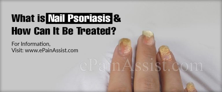 What is Nail Psoriasis & How Can It Be Treated?