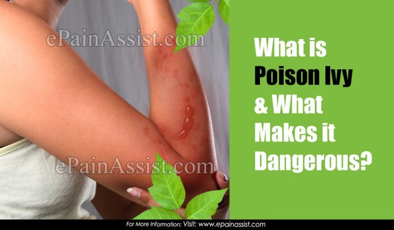What is Poison Ivy & What Makes it Dangerous?