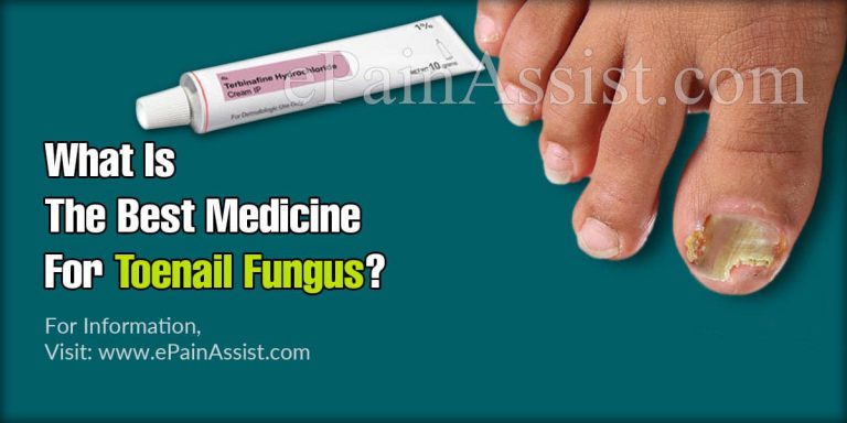 What Is The Best Medicine For Toenail Fungus?