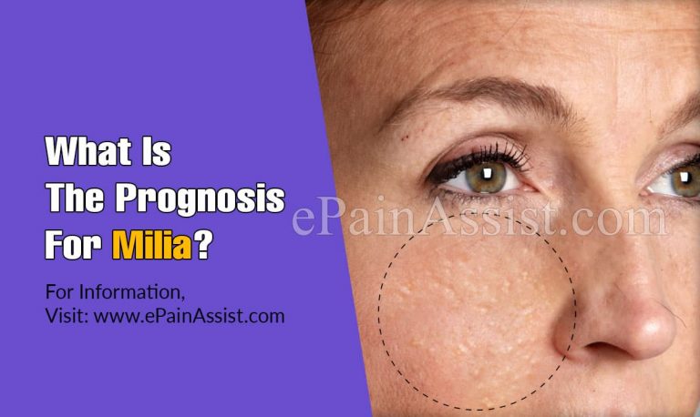 What Is The Prognosis For Milia?