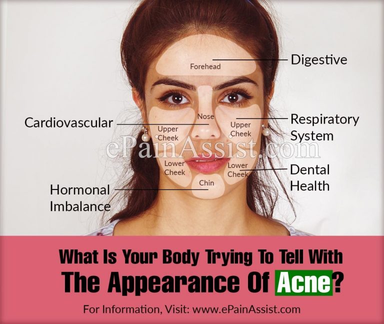 What Is Your Body Trying To Tell With The Appearance Of Acne?