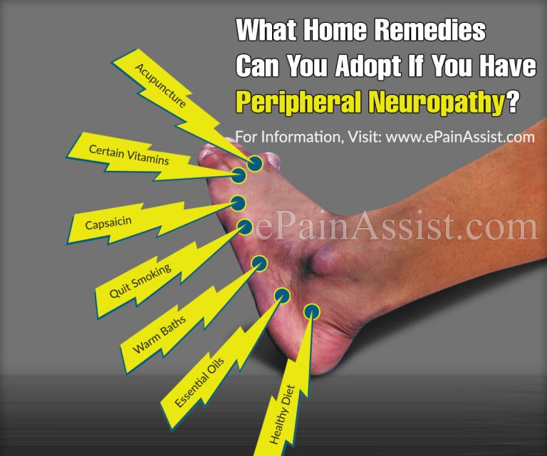 Home Remedies For Peripheral Neuropathy