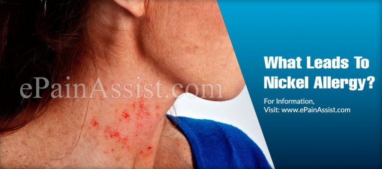 What Leads To Nickel Allergy & Can It Be Cured?