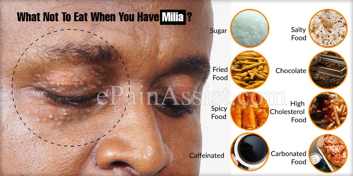 What Not To Eat When You Have Milia?