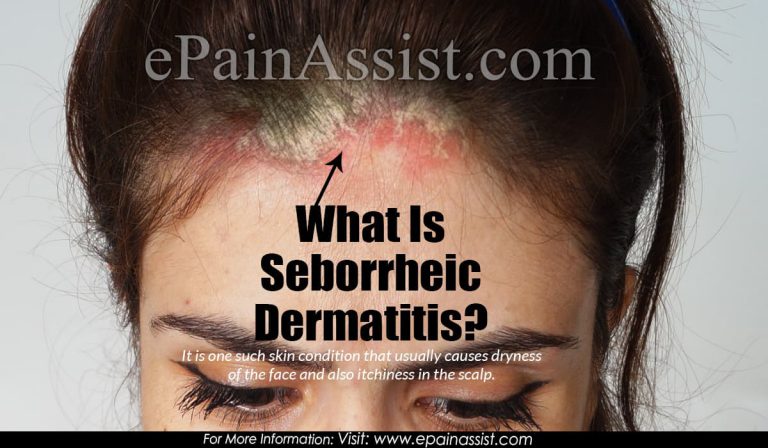 What Vitamin Deficiency Causes Seborrheic Dermatitis & How To Get Rid of It?