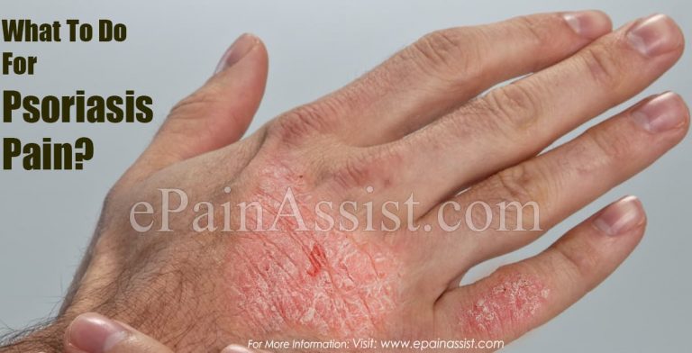 What To Do For Psoriasis Pain?
