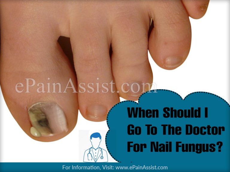 When Should I Go To The Doctor For Nail Fungus?