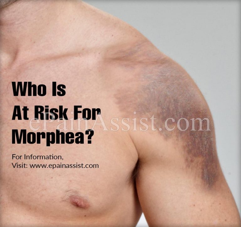 Who Is At Risk For Morphea?