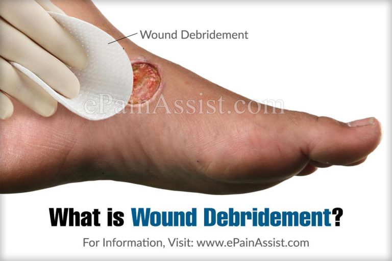 Wound Debridement and is it Necessary?