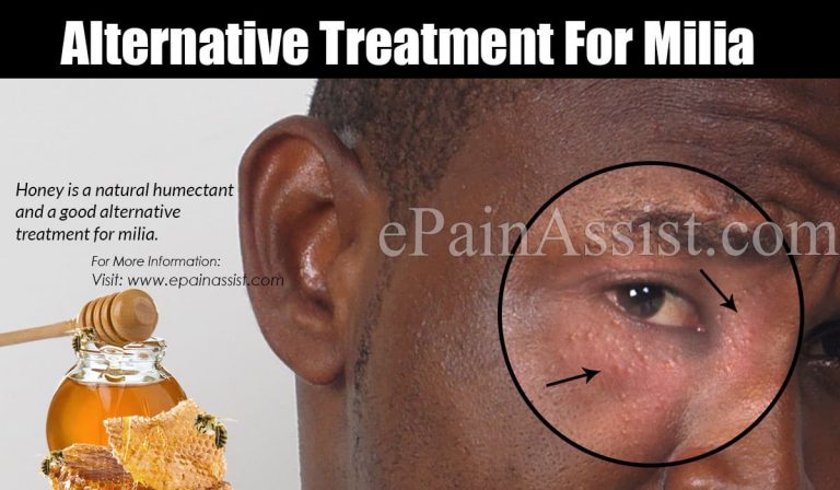 Alternative Treatment For Milia