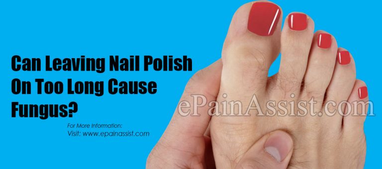 Can Leaving Nail Polish On Too Long Cause Fungus?