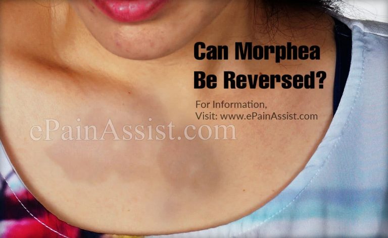 Can Morphea Be Reversed?
