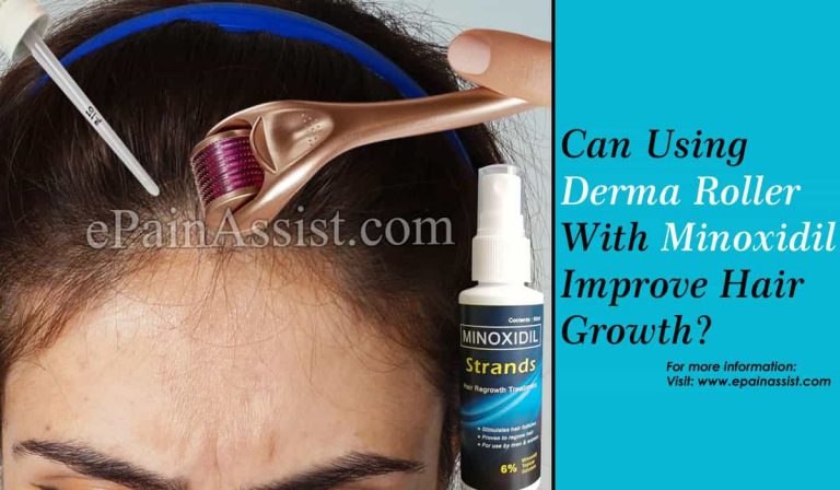 Can Using Derma Roller With Minoxidil Improve Hair Growth?