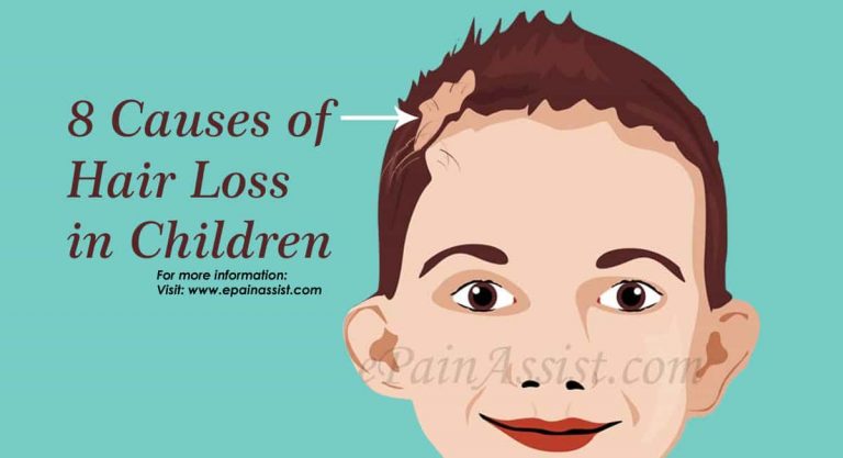 8 Causes For Hair Loss In Children